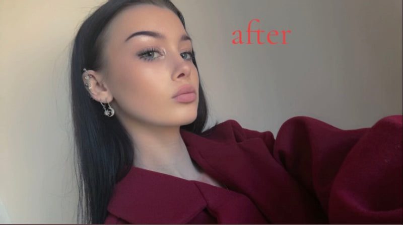 After image